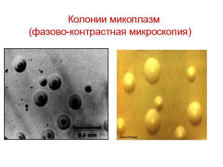 FКолонии микоплазм (фазово-контрастная микроскопия) 