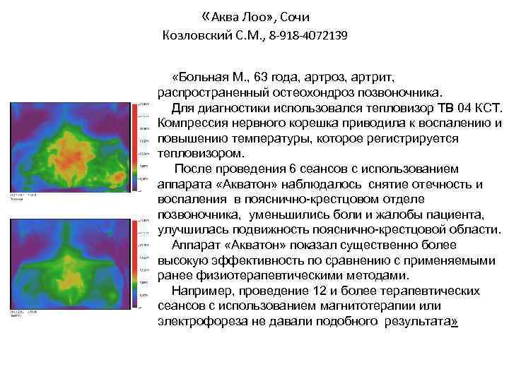  «Аква Лоо» , Сочи Козловский С. М. , 8 -918 -4072139 «Больная М.
