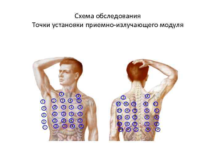 Схема обследования Точки установки приемно-излучающего модуля 