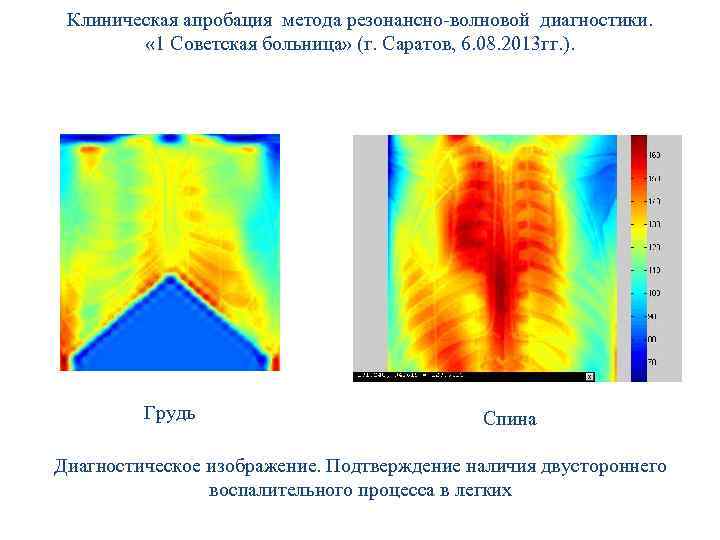 Клиническая апробация метода резонансно-волновой диагностики. « 1 Советская больница» (г. Саратов, 6. 08. 2013