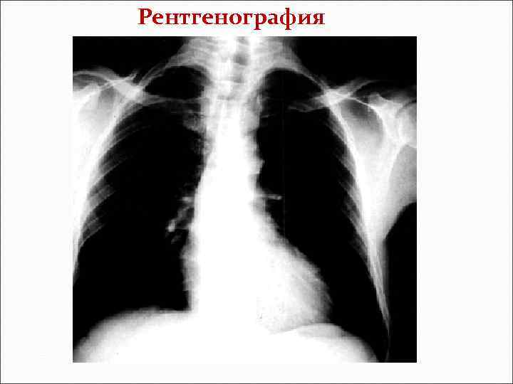 Рентгенография 