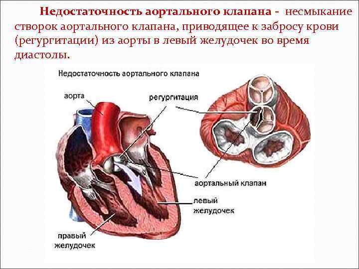 Площадь открытия аортального клапана