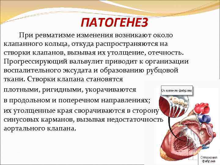 ПАТОГЕНЕЗ При ревматизменения возникают около клапанного кольца, откуда распространяются на створки клапанов, вызывая их