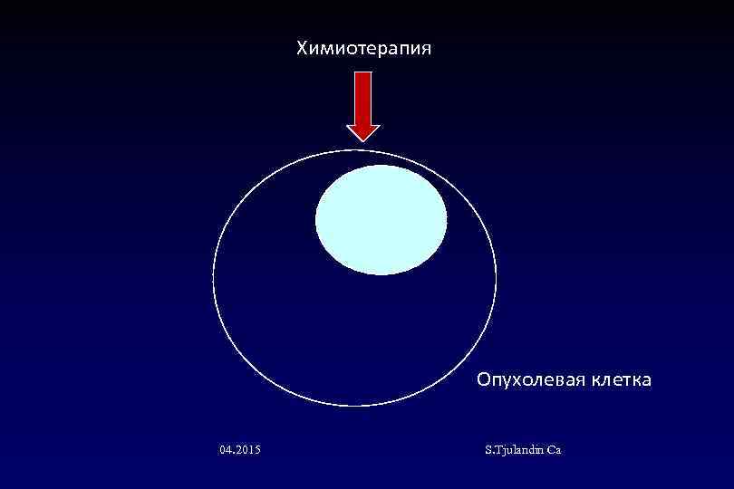Химиотерапия Опухолевая клетка 04. 2015 S. Tjulandin Са 