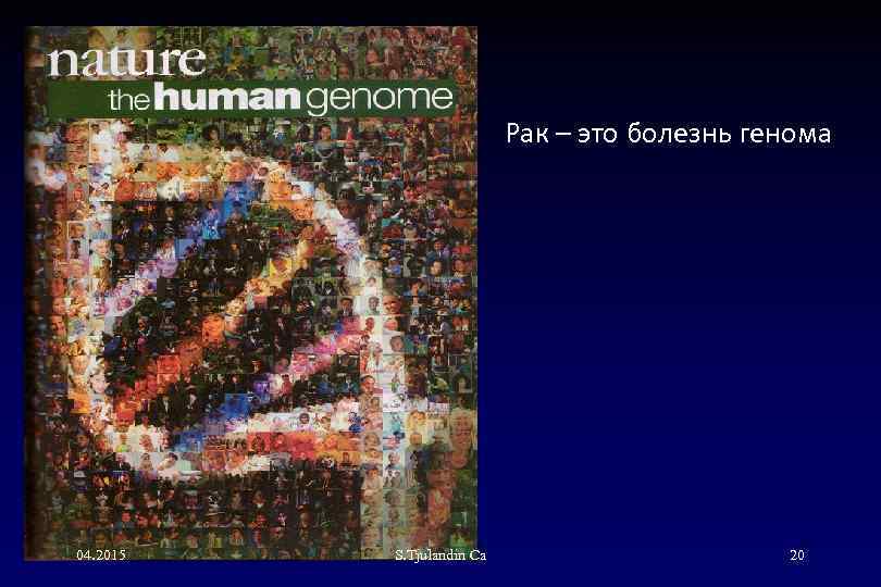 Рак – это болезнь генома 04. 2015 S. Tjulandin Са 20 