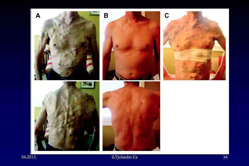 04. 2015 S. Tjulandin Са 34 