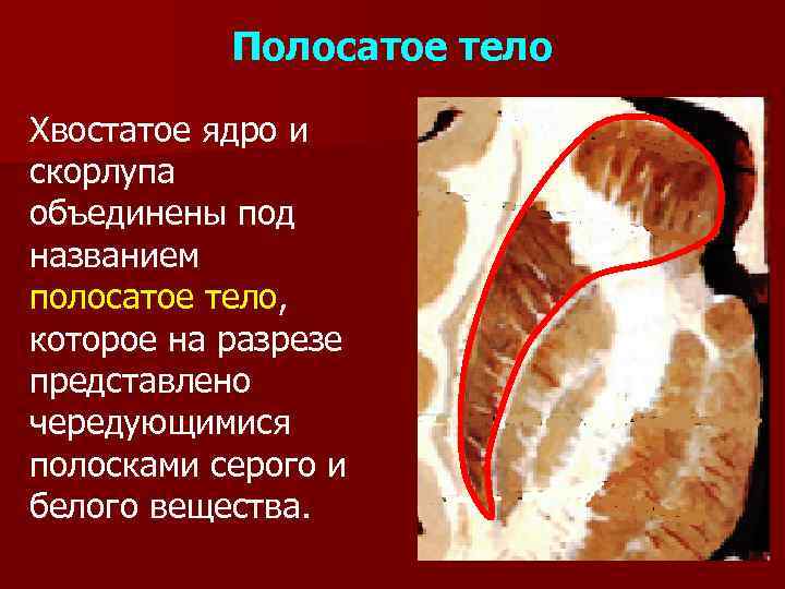 Полосатое тело. Полосатое тело на разрезе. Полосатое тело мозга. Полосатое тело конечного мозга.