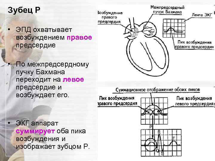 Зубец P • ЭПД охватывает возбуждением правое предсердие • По межпредсердному пучку Бахмана переходит
