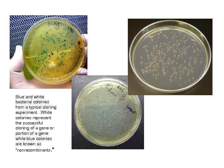 Blue and white bacterial colonies from a typical cloning experiment. White colonies represent the