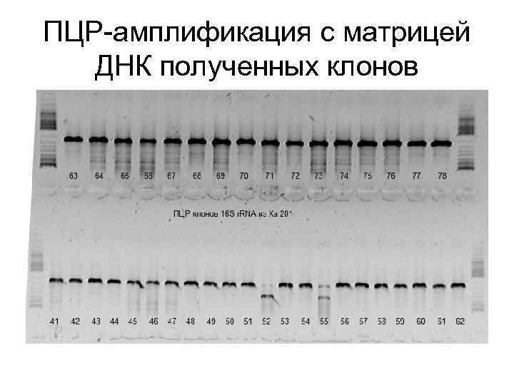 ПЦР-амплификация с матрицей ДНК полученных клонов 