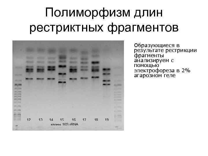 Полиморфизм длин рестриктных фрагментов Образующиеся в результате рестрикции фрагменты анализируем с помощью электрофореза в