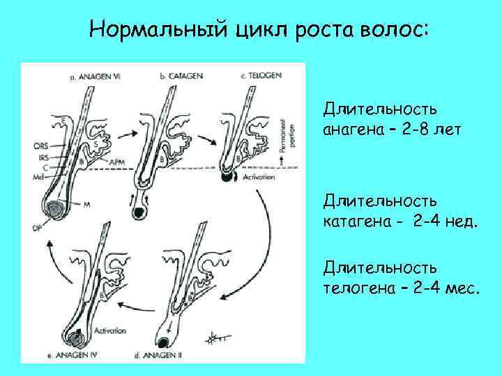 Нормальный цикл роста волос: Длительность анагена – 2 -8 лет Длительность катагена - 2