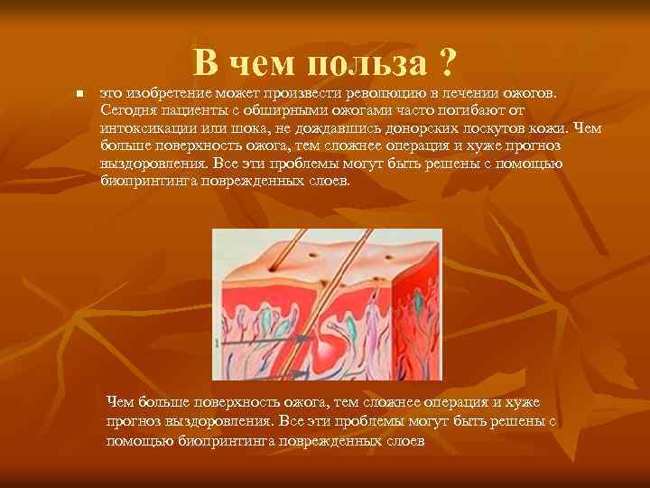 В чем польза ? n это изобретение может произвести революцию в лечении ожогов. Сегодня