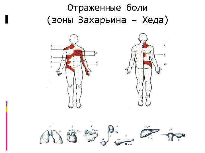 Отраженные боли (зоны Захарьина – Хеда) 