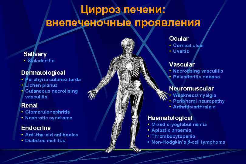 Цирроз печени: внепеченочные проявления Ocular • Corneal ulcer • Uveitis Salivary • Sialadenitis Vascular