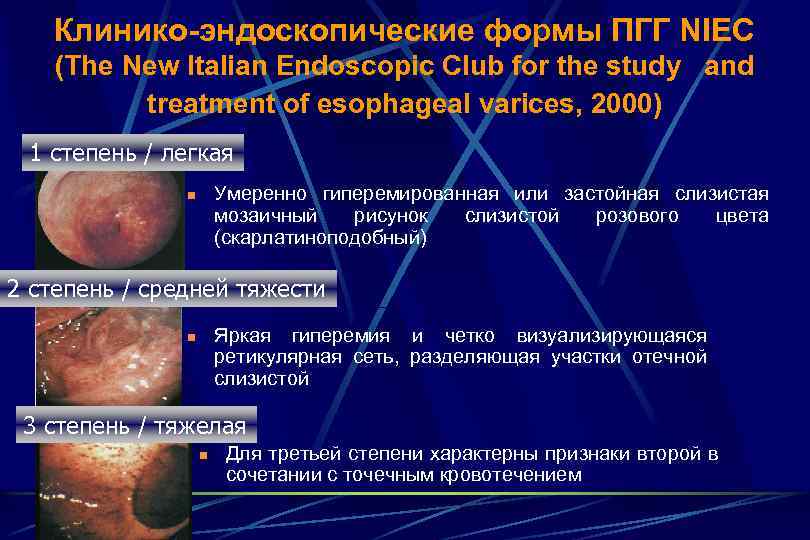 Клинико-эндоскопические формы ПГГ NIEC (The New Italian Endoscopic Club for the study and treatment