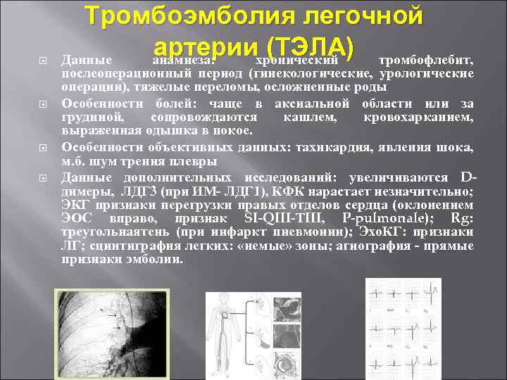 Инфаркт пневмония презентация