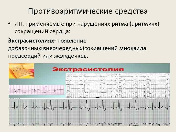 Противоаритмические средства • ЛП, применяемые при нарушениях ритма (аритмиях) сокращений сердца: Экстрасистолиях- появление добавочных(внеочередных)сокращений