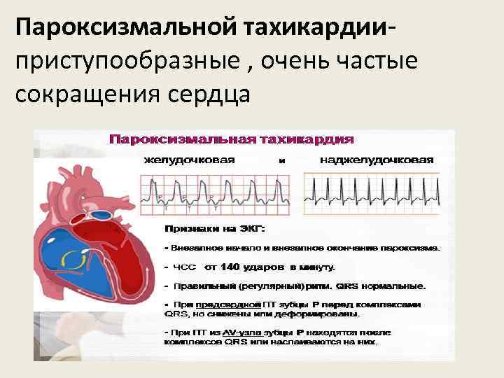 Пароксизмальной тахикардииприступообразные , очень частые сокращения сердца 