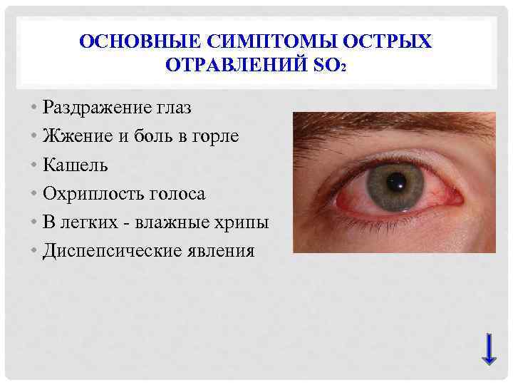 ОСНОВНЫЕ СИМПТОМЫ ОСТРЫХ ОТРАВЛЕНИЙ SO 2 • Раздражение глаз • Жжение и боль в