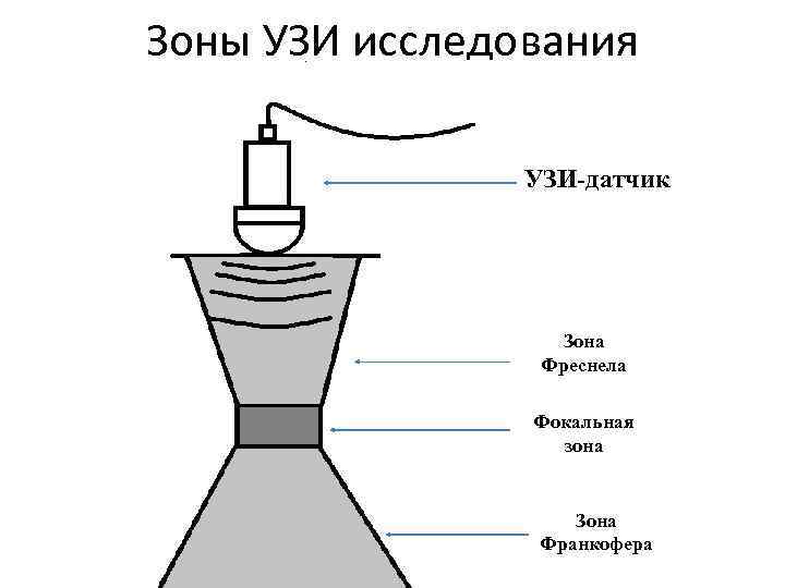 Зоны УЗИ исследования УЗИ-датчик Зона Фреснела Фокальная зона Зона Франкофера 