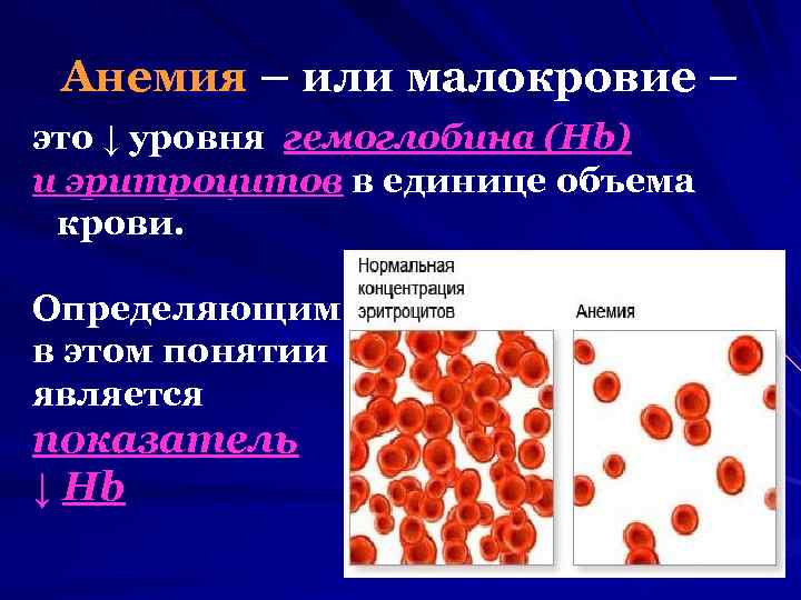 Малокровие причины и лечение. Заболевание крови анемия. Анемия эритроциты.