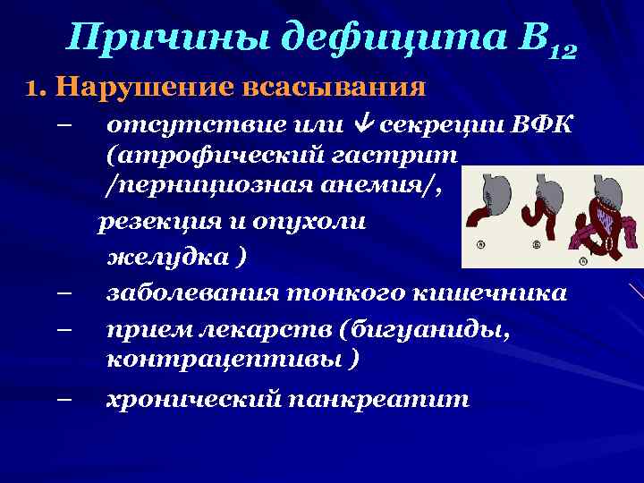 Причины дефицита В 12 1. Нарушение всасывания отсутствие или секреции ВФК (атрофический гастрит /пернициозная