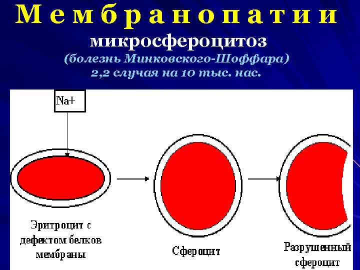 Анемия минковского шоффара у детей