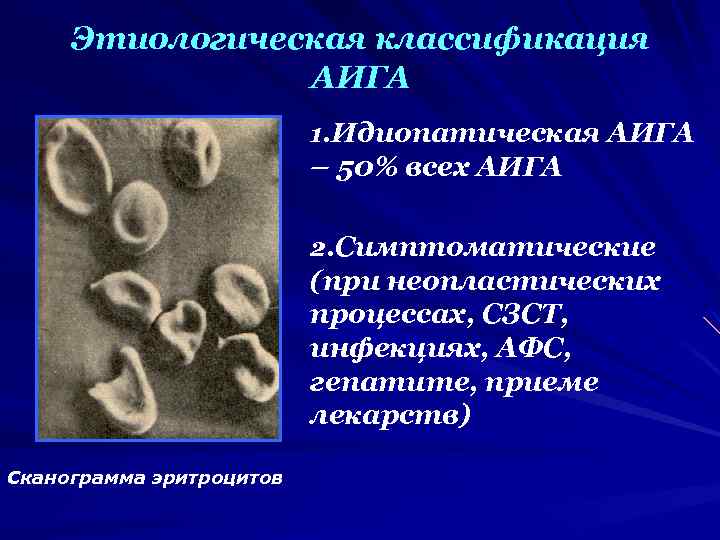 Этиологическая классификация АИГА 1. Идиопатическая АИГА – 50% всех АИГА 2. Симптоматические (при неопластических