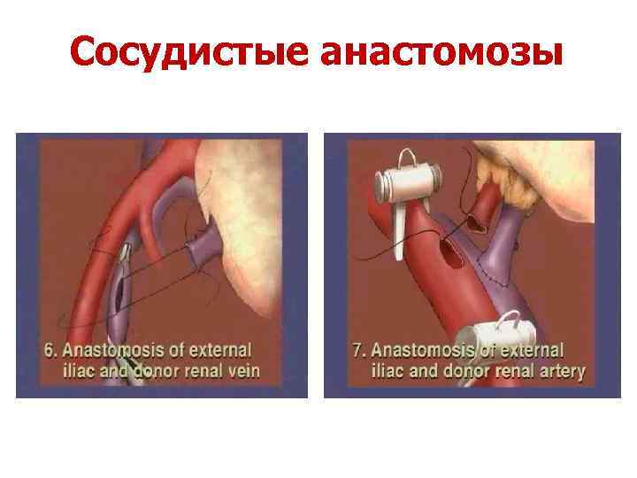 Cосудистые анастомозы 