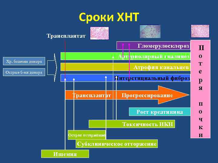 Сроки ХНТ Трансплантат Гломерулосклероз Артериолярный гиалиноз Хр. болезни донора Атрофия канальцев Острые б-ни донора