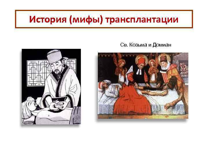 История (мифы) трансплантации Св. Козьма и Домиан 