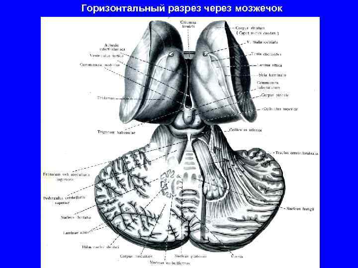 Горизонтальный разрез через мозжечок 