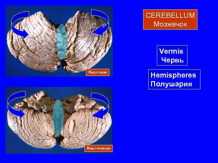 Червь и полушария мозжечка. Дольки мозжечка. Полушария мозжечка. Мозжечок спереди.