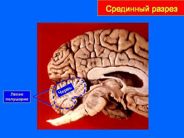 Срединный разрез ь Левое полушарие Ч в ер 