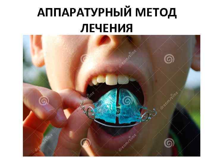 АППАРАТУРНЫЙ МЕТОД ЛЕЧЕНИЯ 
