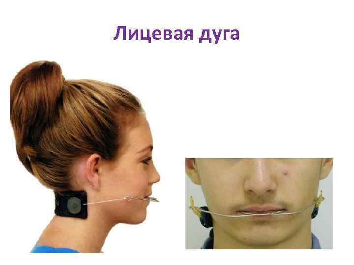 Лицевая дуга 