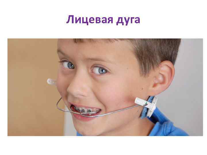 Лицевая дуга 