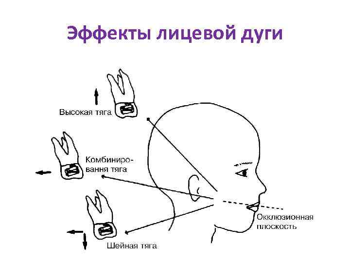 Эффекты лицевой дуги 