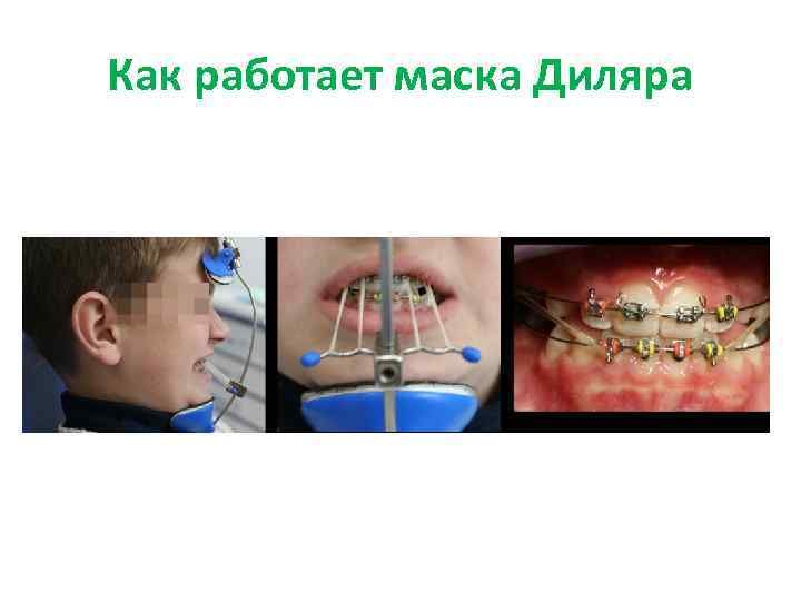 Как работает маска Диляра 