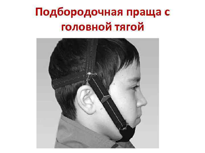 Подбородочная праща с головной тягой 