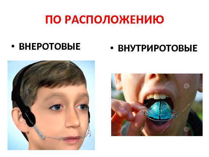 ПО РАСПОЛОЖЕНИЮ • ВНЕРОТОВЫЕ • ВНУТРИРОТОВЫЕ 