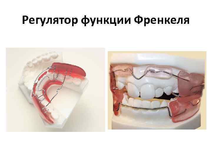 Регулятор функции Френкеля 