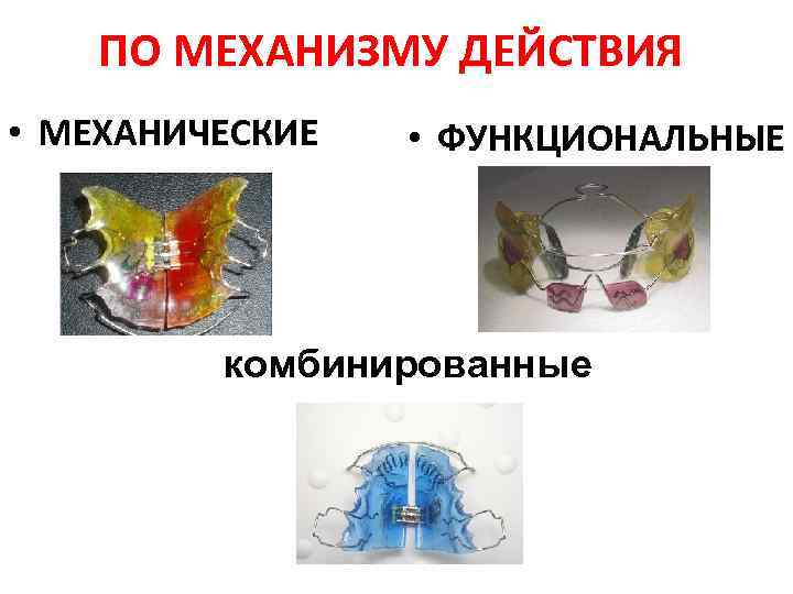 ПО МЕХАНИЗМУ ДЕЙСТВИЯ • МЕХАНИЧЕСКИЕ • ФУНКЦИОНАЛЬНЫЕ комбинированные 