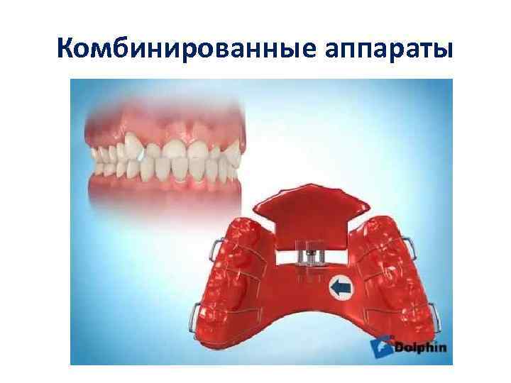 Комбинированные аппараты 