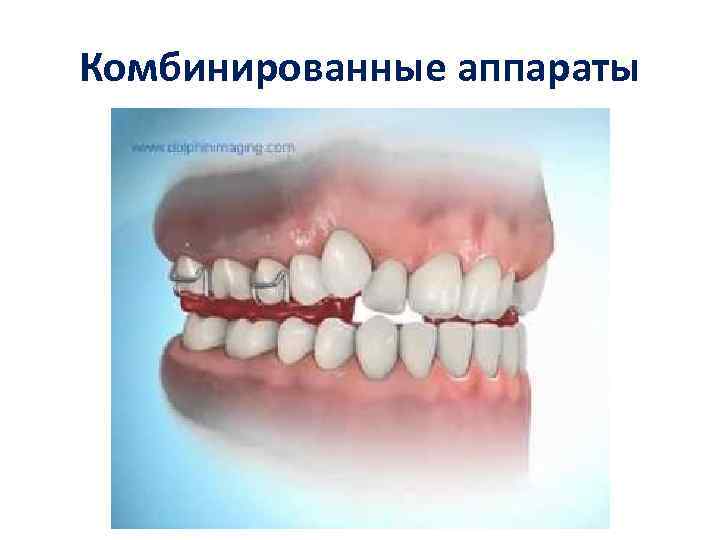 Комбинированные аппараты 