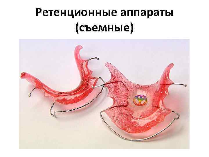 Ретенционные аппараты (съемные) 