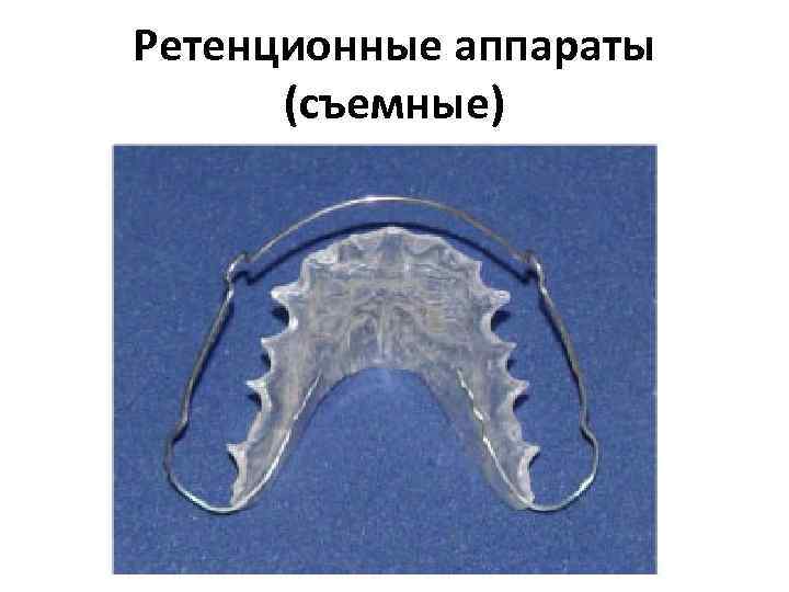 Ретенционные аппараты (съемные) 