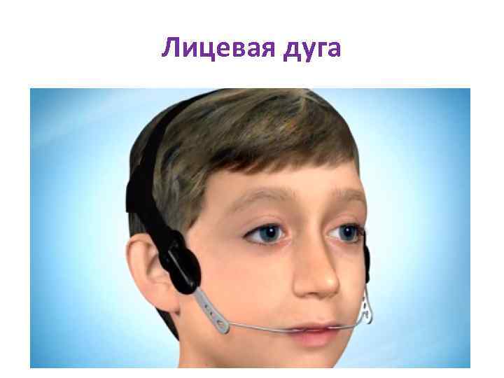 Лицевая дуга 