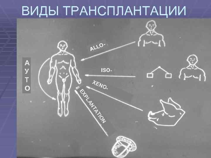 ВИДЫ ТРАНСПЛАНТАЦИИ LLO A ISOXE NO - EX А У Т О ON TI